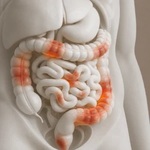 Accompagner la maladie de Crohn et
la rectocolite hémorragique — médecine chinoise