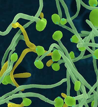 Dépression mentale et candida albicans en médecine chinoise — illustration 1