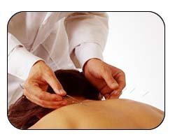 Effet de l’acupuncture dans les séquelles d’A.V.C. — illustration 1