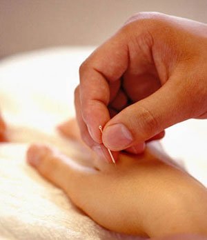 Les scientifiques anglais démontrent la sûreté de l’acupuncture — illustration 1
