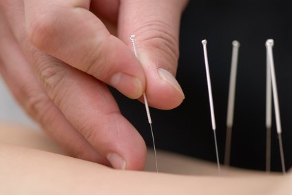 Maladie d’Alzheimer et acupuncture — illustration 1